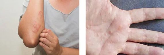 Nước Cứng Ảnh Hưởng Đến Ngôi Nhà Của Bạn Như Thế Nào?